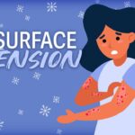Cold, dry winter air can cause skin problems, especially with age Cold, dry winter air can cause skin problems, especially with age