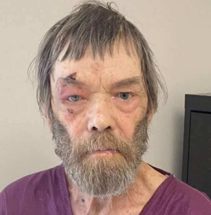 Mississippi issues Silver Alert for 63-year-old Jackson man